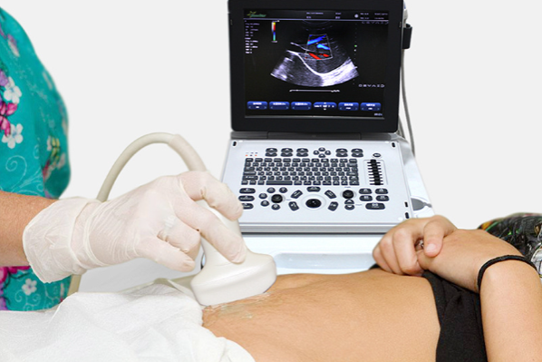 B超机.png B超机.png